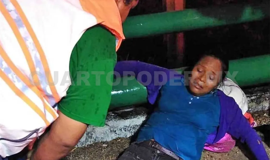 La mujer resultó con una pierna rota debido al impacto, por lo que fue auxiliada y luego trasladada a un hospital. Ulises López / CP