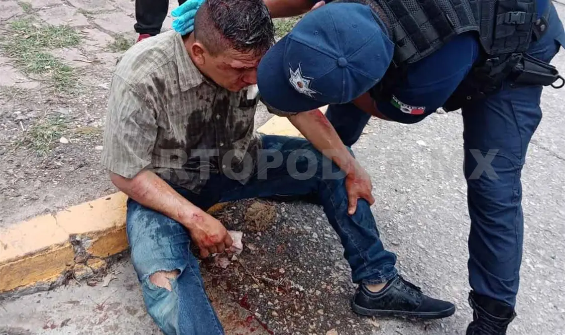 Impactan a motociclista y termina malherido