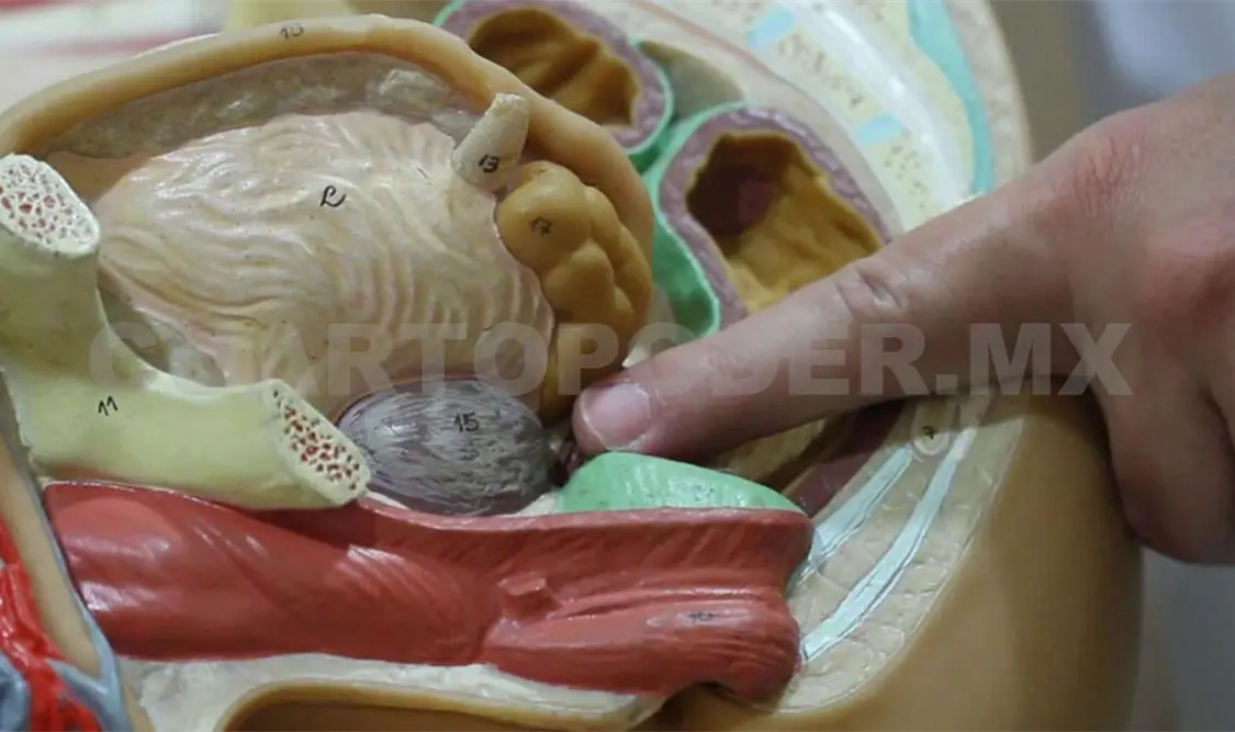Cáncer de próstata, el terror de los hombres
