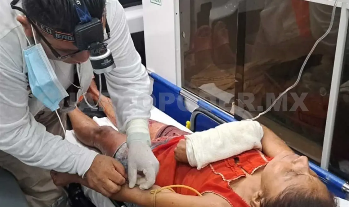 El furioso hombre casi le arranca el brazo a machetazos al descubrirla platicando con un amigo. Genaro Sánchez / CP