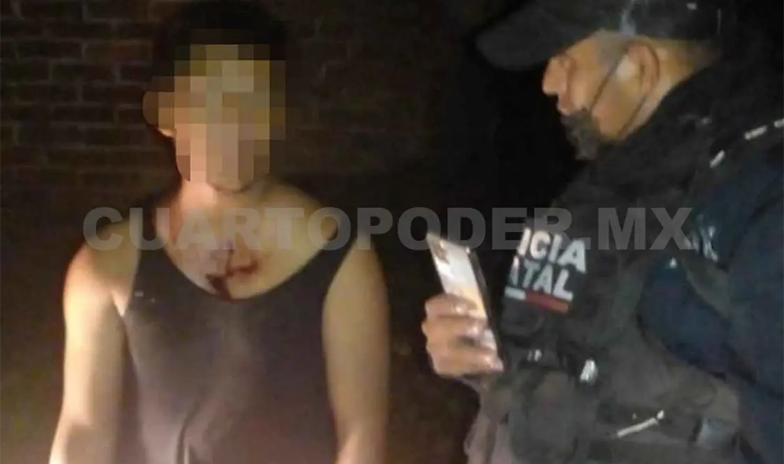 Joven es baleado en riña y lo hospitalizan