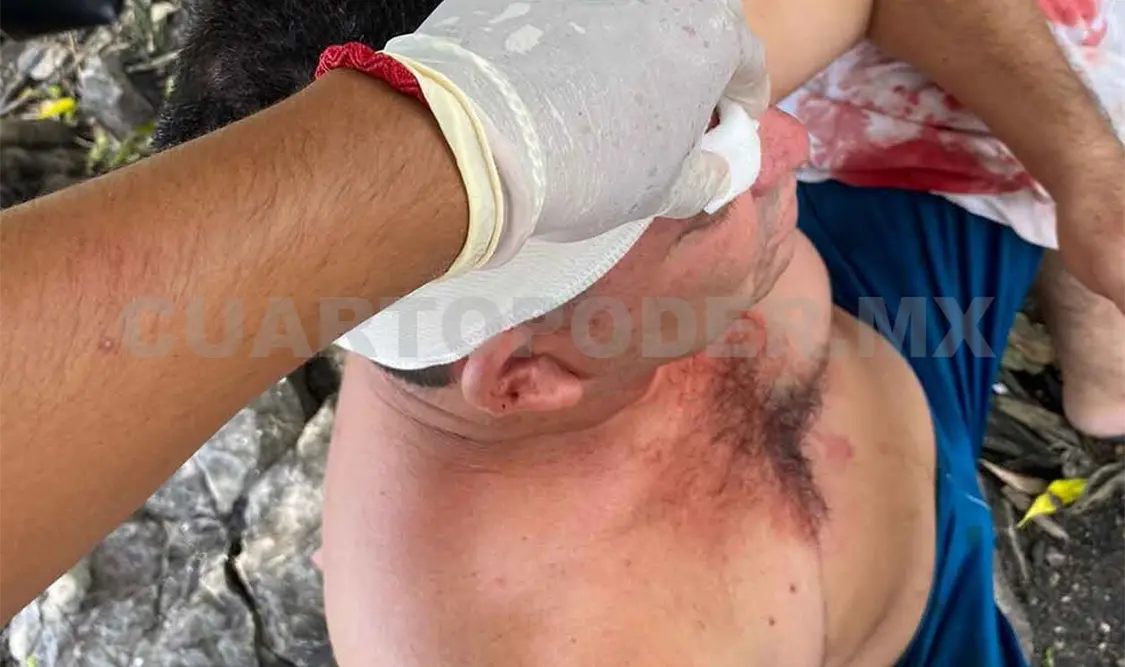 Chofer termina con herida en la cabeza
