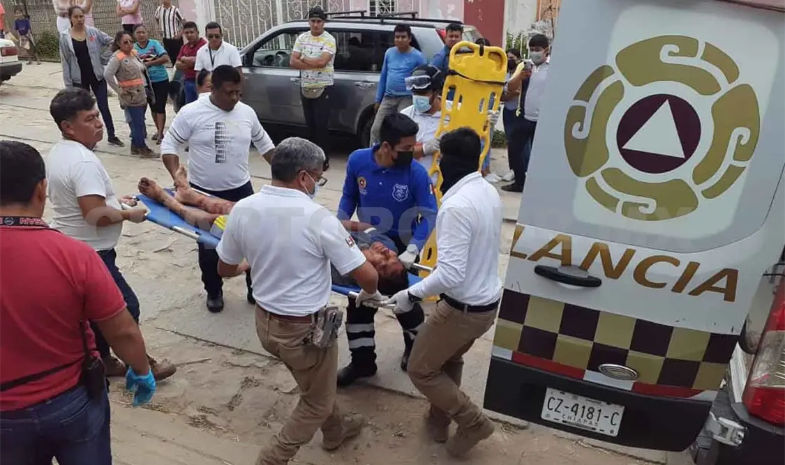 Lo atacó un pitbull y casi pierde un brazo