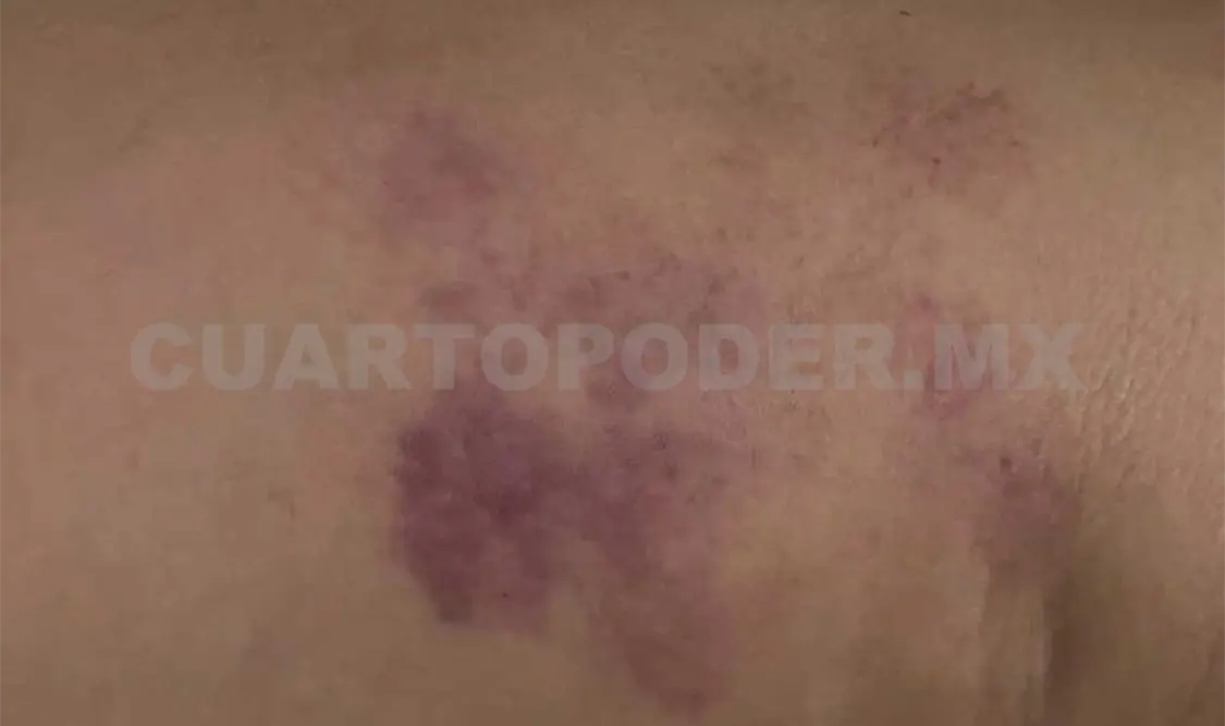 El menor en cuestión resultó con signos de violencia. CP