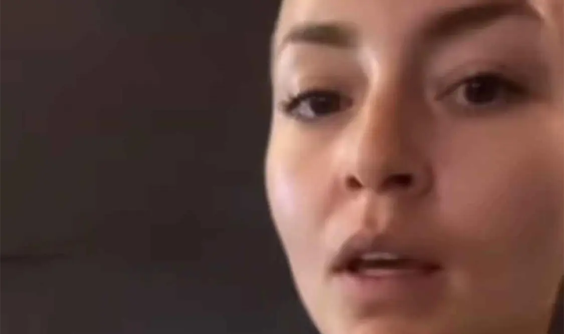 Se le irrita el rostro a Angelique Boyer