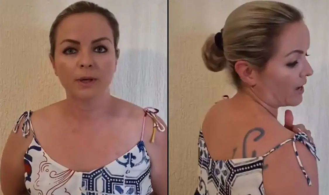 “Me marcó con un hierro como ganado”, dice mujer