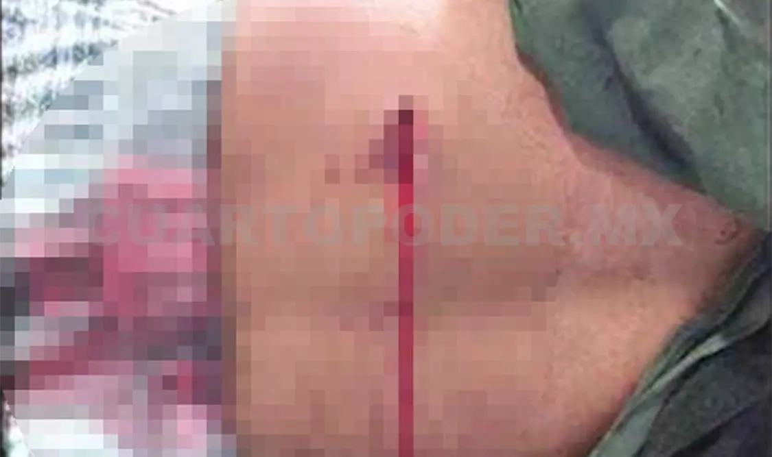 Su amigo de parranda lo ataca con un cuchillo