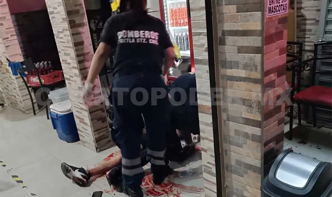 Balean a sujeto y queda gravemente lesionado