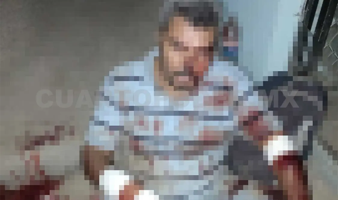 Machetea a migrante en un violento asalto
