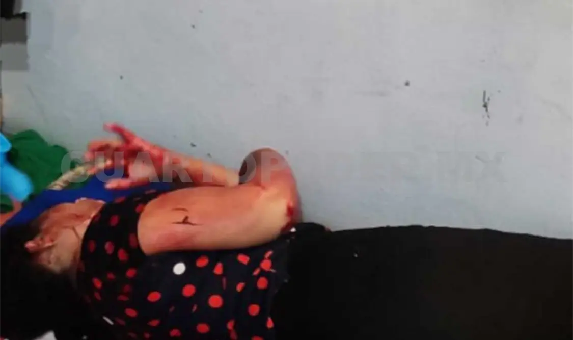 La mujer fue valorada por PC y la trasladaron de emergencia a un hospital. Genaro Sánchez / CP