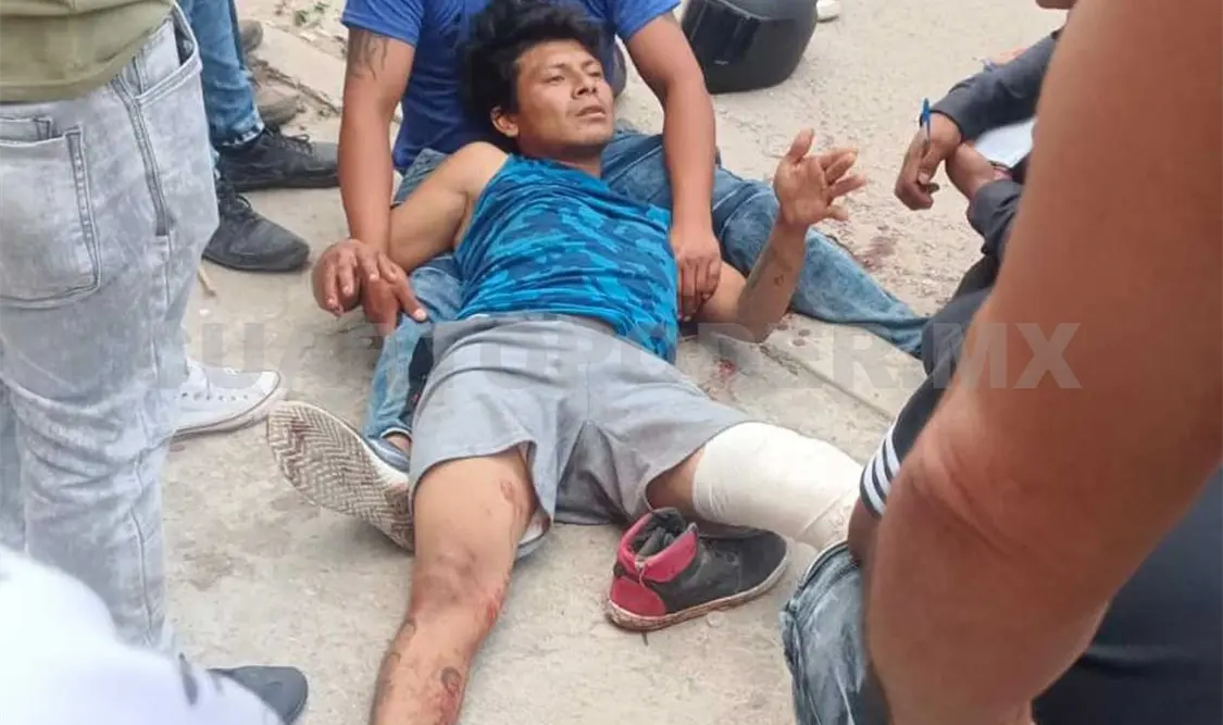 Se le atravesó un perro y se incrusta en vehículo