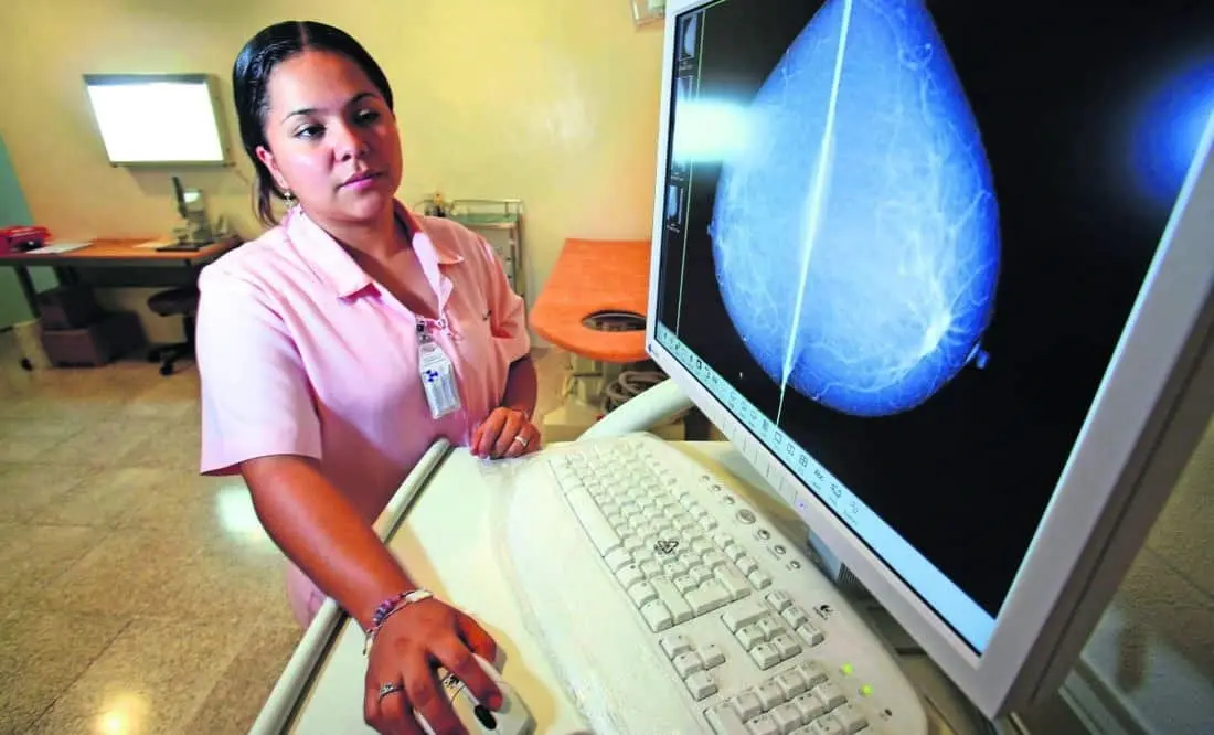 La Organización Mundial de la Salud y especialistas piden que sea publicada la nueva norma relativa al cáncer de mama. El Universal