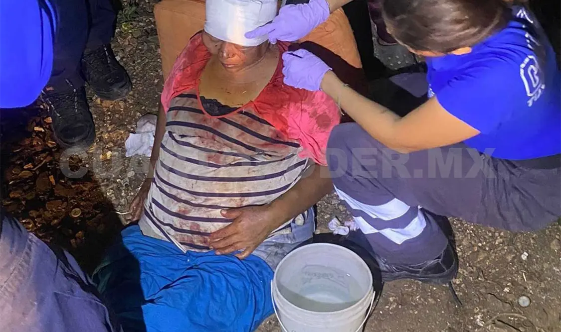 Le propinan golpiza a mujer de la tercera edad