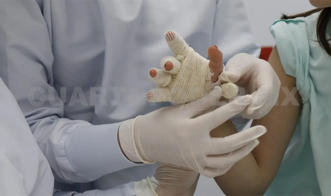 Urgente unidad médica para menores quemados