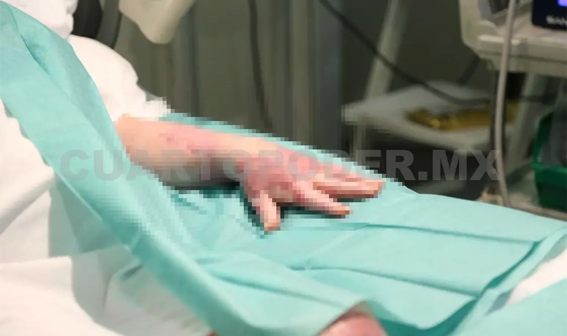 Al menos 80 casos de menores con quemaduras