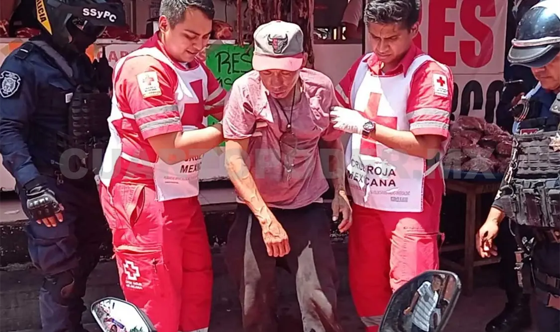 Daniel “N” fue llevado de urgencia a un hospital, pues las lesiones eran graves. Ulises López / CP