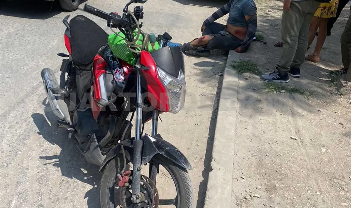 Kevin Arami “N” hizo una mala maniobra y cayó sobre el pavimento, quedando con múltiples excoriaciones y contusiones. Ulises López / CP