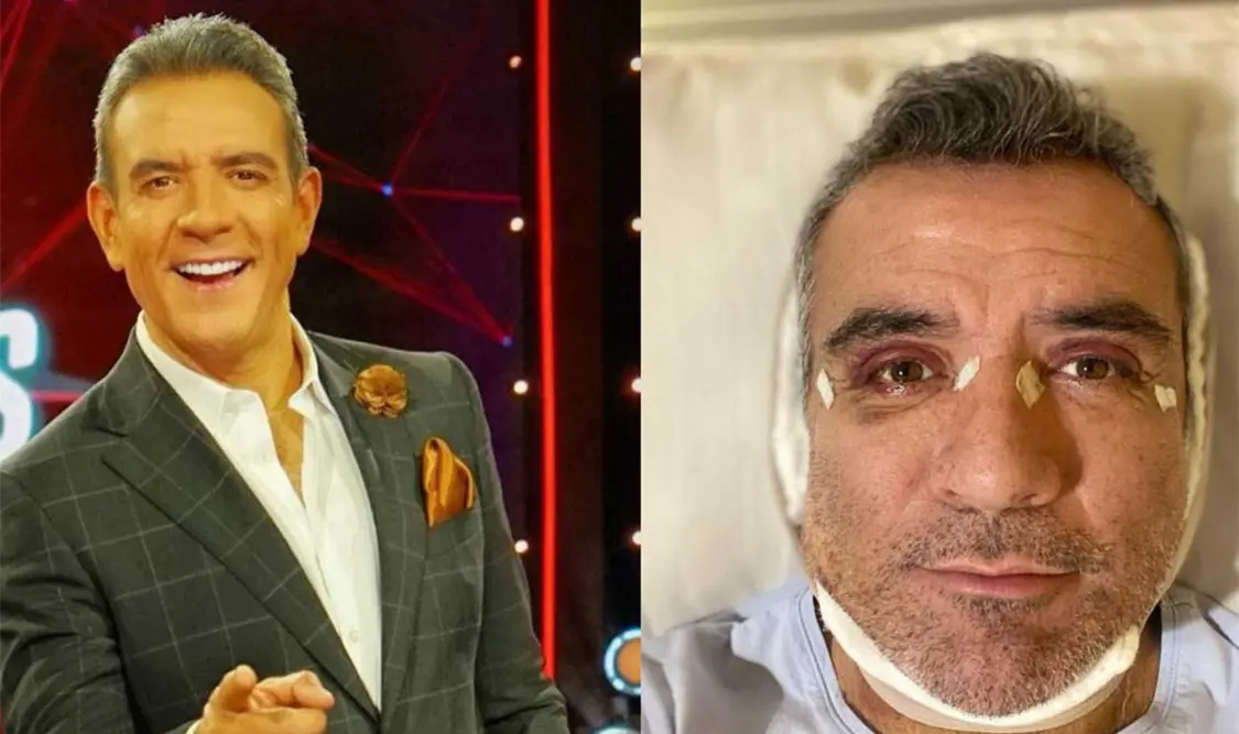 Héctor Sandarti entra a cirugía
