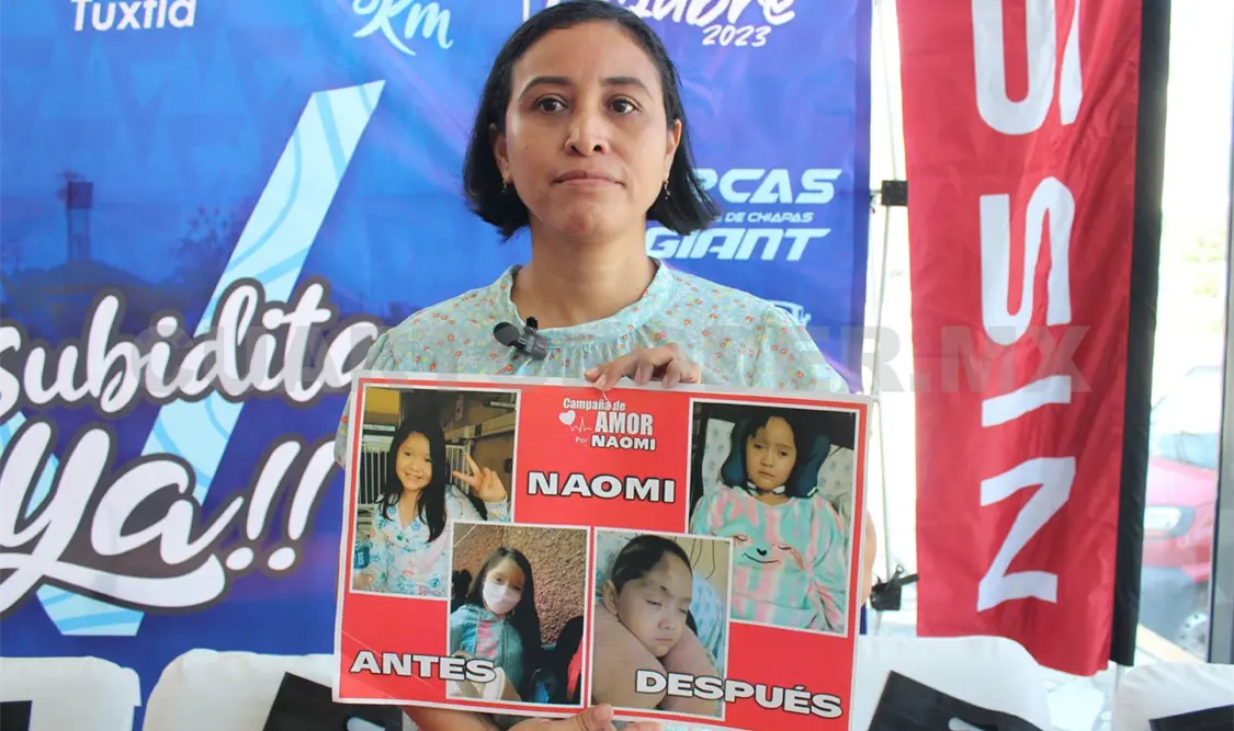 Naomi requiere de apoyo para recuperar su salud