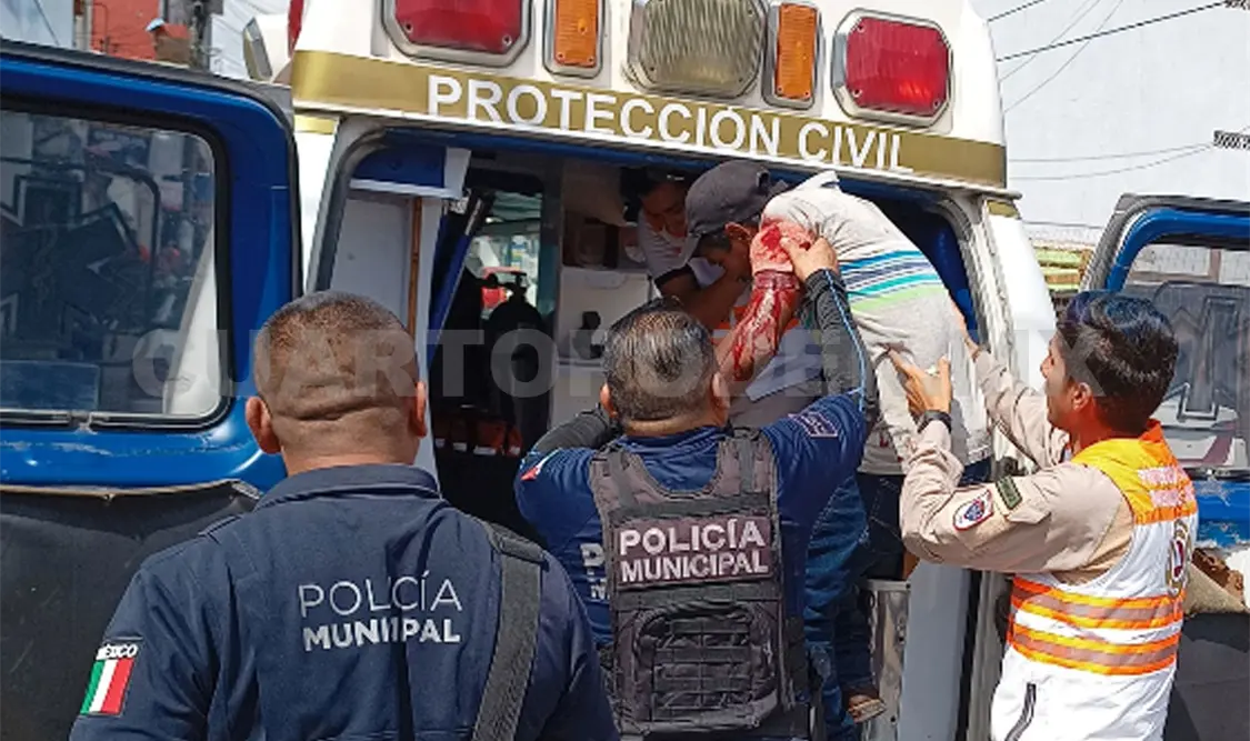 Es atacado por otro sujeto;acabó herido