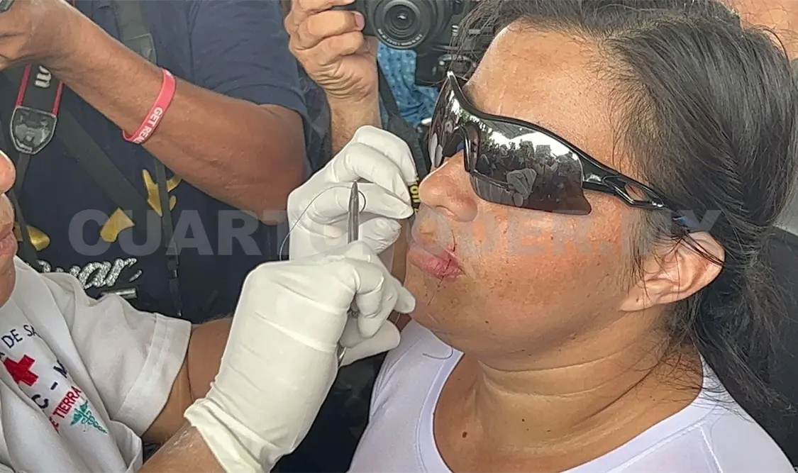 Migrantes se cosen los labios en Huixtla