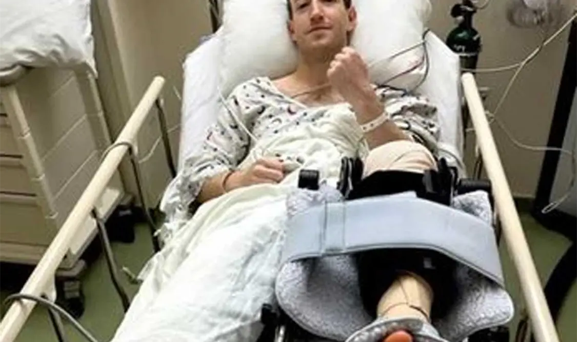 Según Stanford Medicine, la rehabilitación de la cirugía del LCA puede llevar varios meses. Cortesía