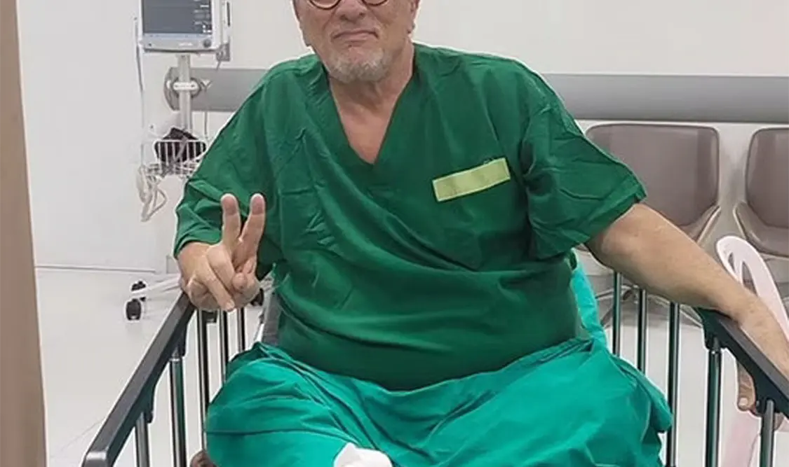 Actor pierde dos dedos