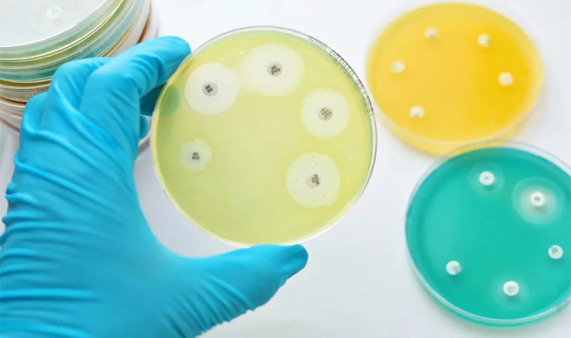 Resistencia a los antimicrobianos: amenaza a la salud