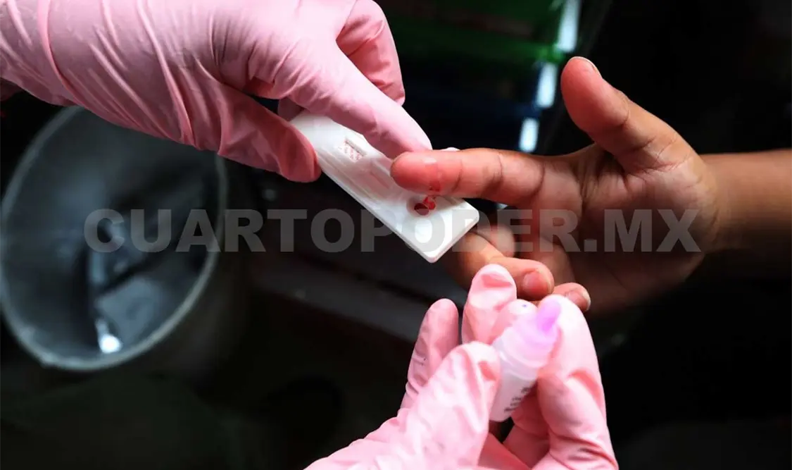 Flujo migratorio no ha elevado casos de VIH