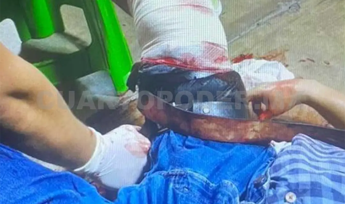 Violenta riña de vecinos salda con un lesionado
