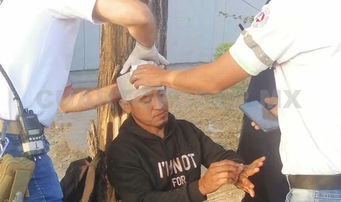 Recibe dos machetazos durante violento asalto