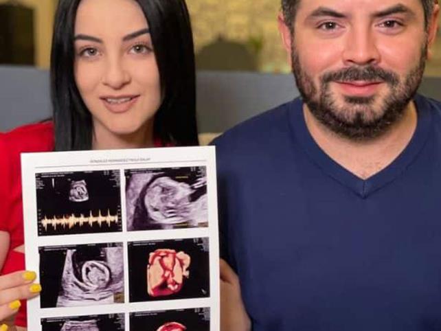 José Eduardo y su novia esperan bebé