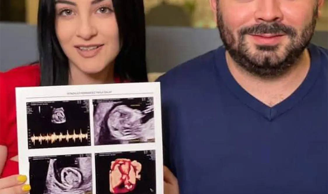 José Eduardo y su novia esperan bebé
