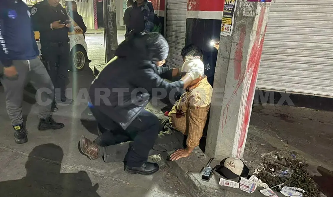 Lo dejaron con el rostro ensangrentado en riña
