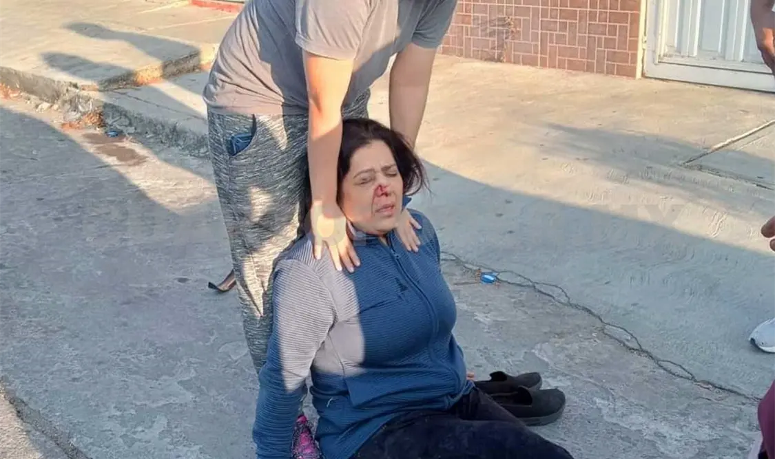 Atropella a una transeúnte para luego darse a la fuga