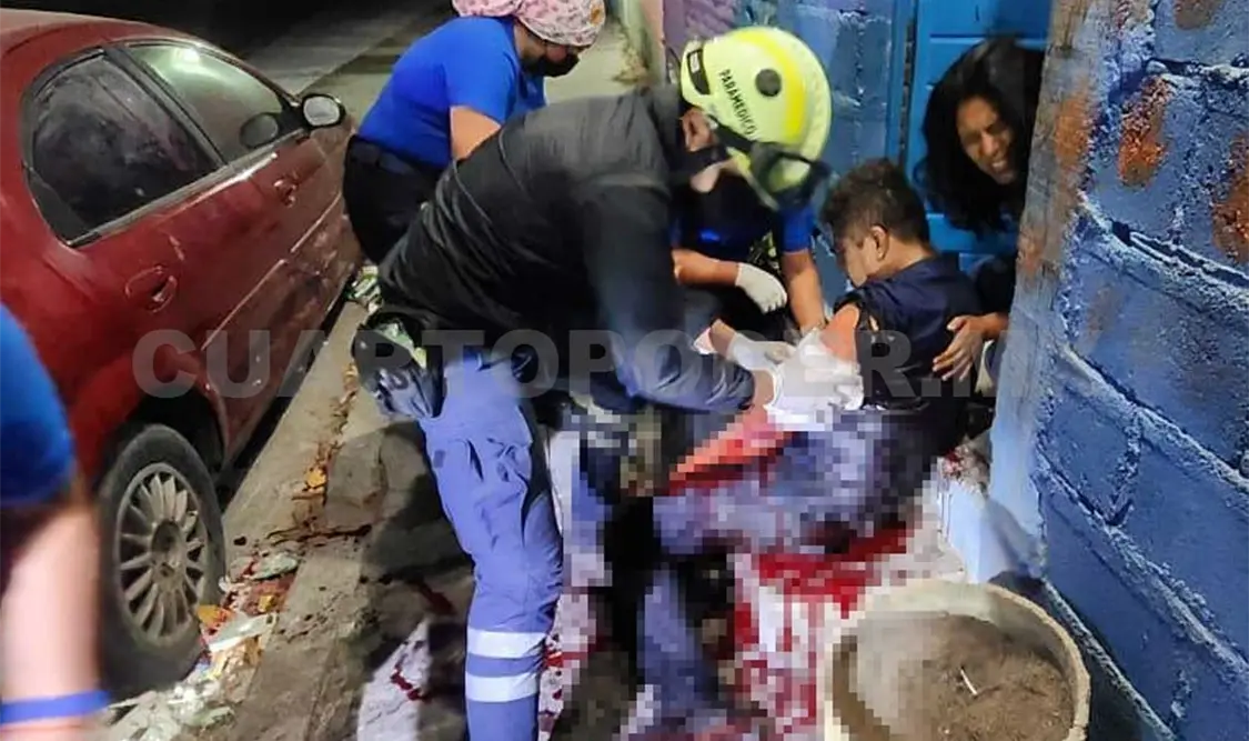 Lo machetean en riña y casi le cercenan el brazo