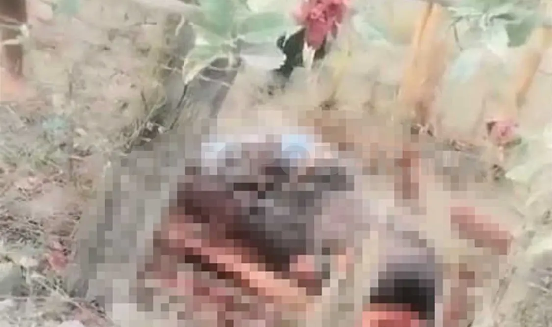 Su “amigo” le cercena un brazo a machetazos