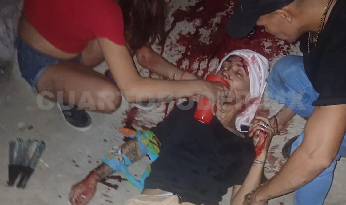 En asalto hieren a machetazos a salvadoreño