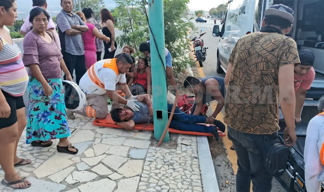 Atropellan a peatón y termina fracturado