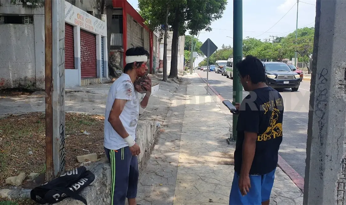 Atropellan a peatón y termina lesionado