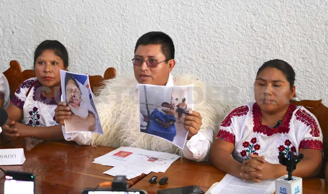 Candidata denuncia VPRG