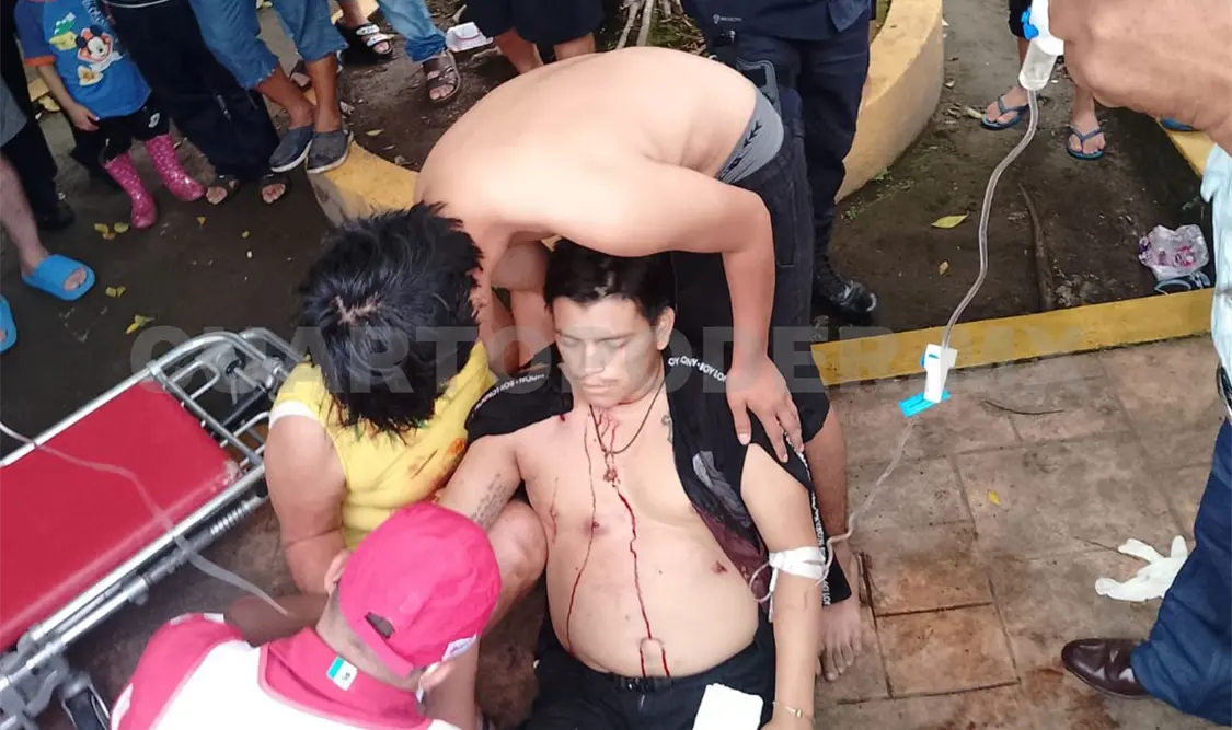 A balazos ejecutan a un hombre en parque