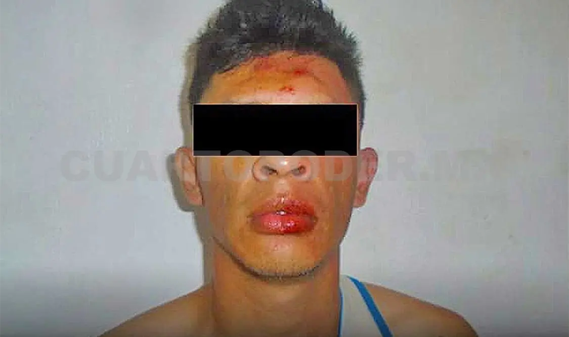 El furibundo sujeto fue arrestado por la agresión. Osman Toledo / CP