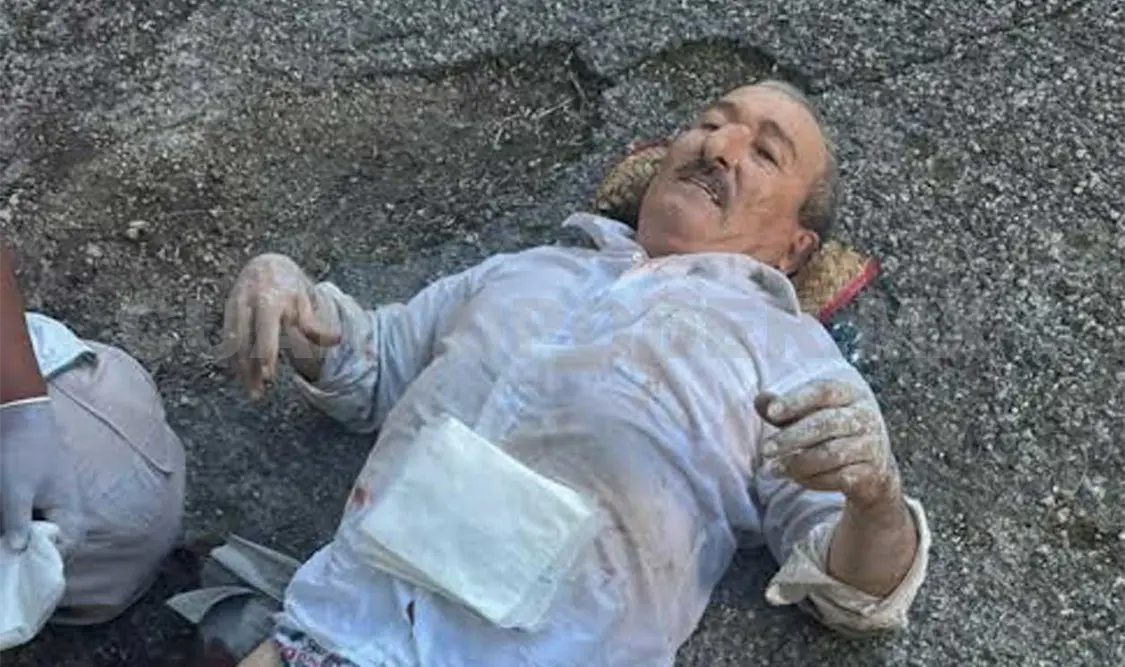 Por evitar que le quitaran su unidad, un hombre recibió un disparo en la pierna. Ulises Villalobos / CP