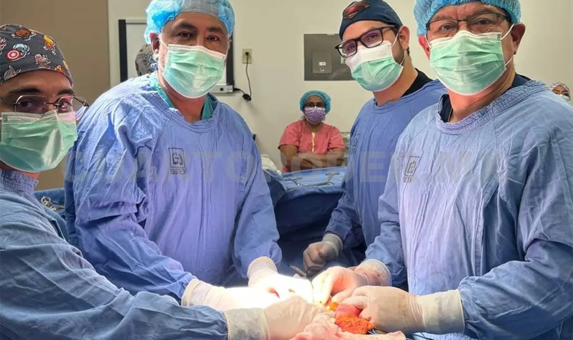 Este tipo de operaciones es único en el estado. CP