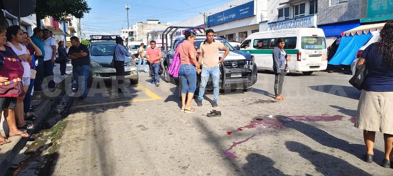 Atropellan a peatón y sufre amputación parcial