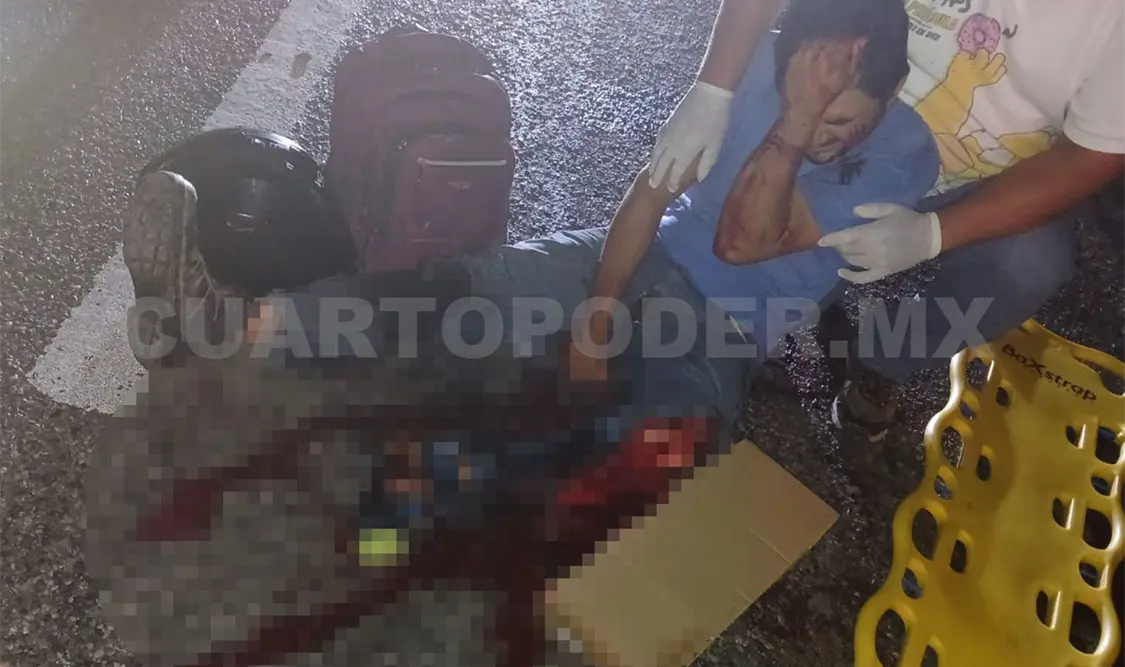 Casi le cercenan una pierna al ser atropellado
