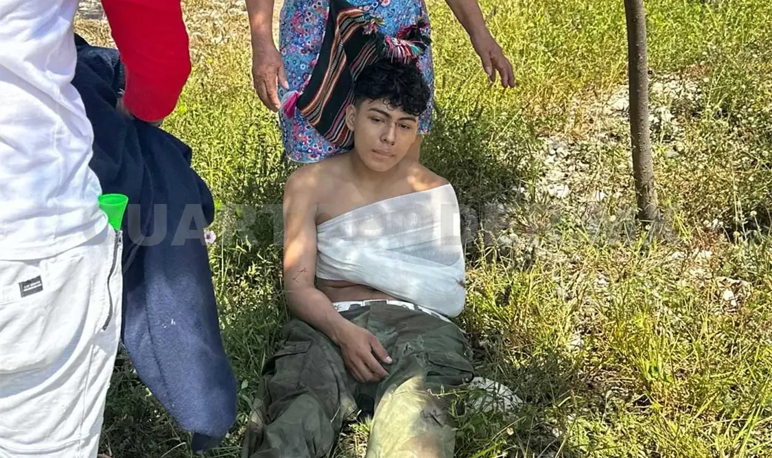 Queda con luxación en un hombro al accidentarse
