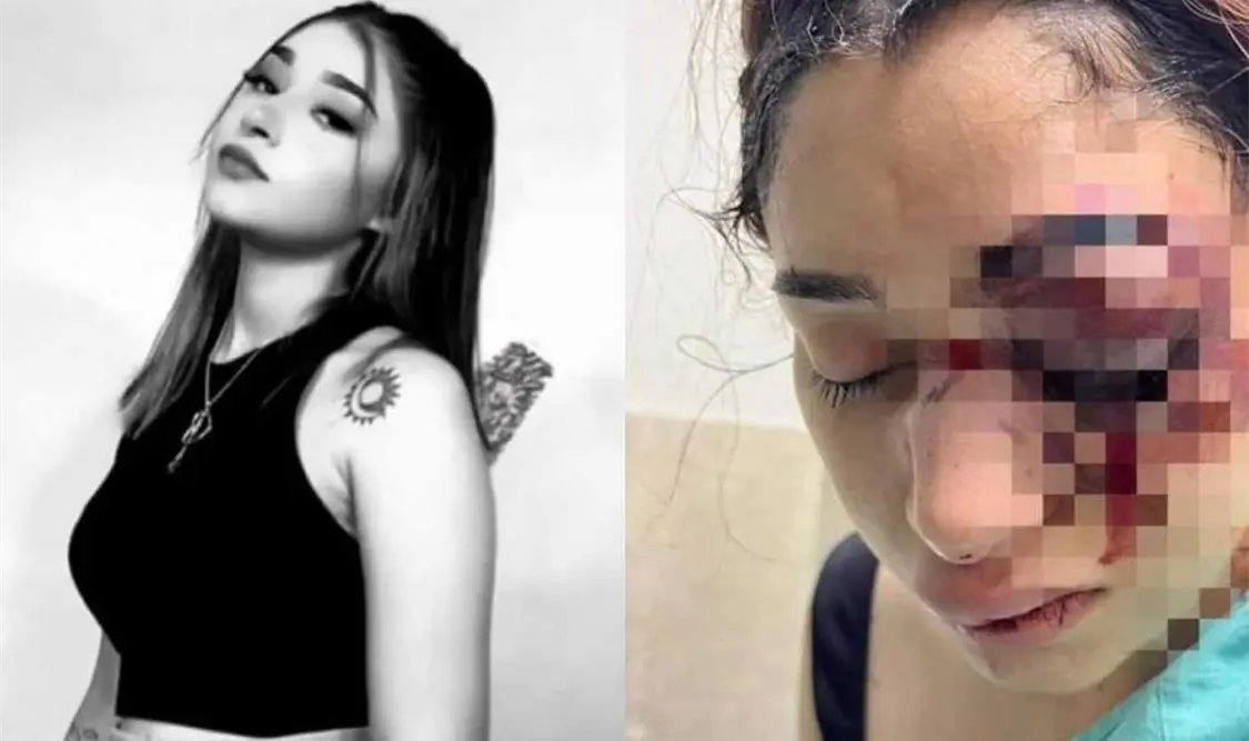 Melanie de Jesús sufrió una agresión por parte de su novio. Cortesía