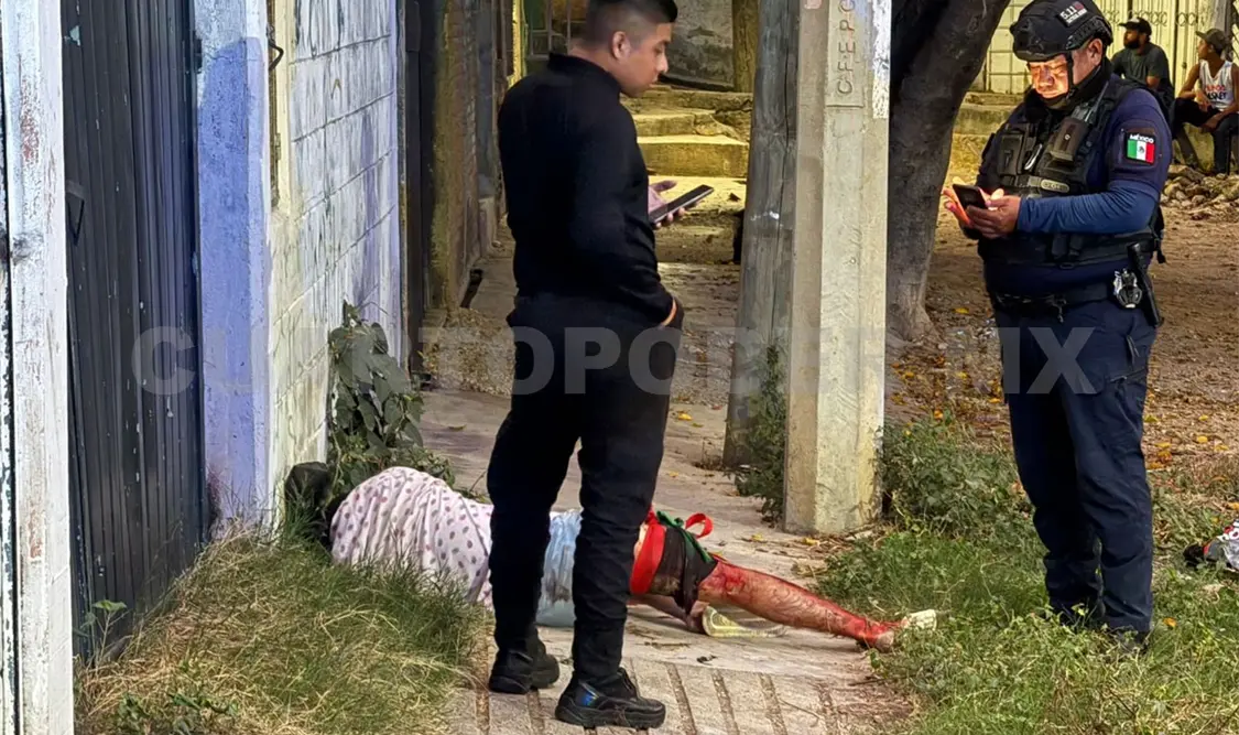 Se opone a asalto, lo acuchillan y golpean